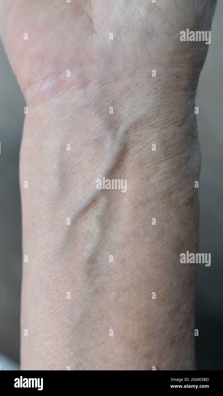 Nel sud-est asiatico, l’avambraccio di una donna anziana del Myanmar. Le pieghe della pelle, la pelle allentata e le vene mostrano invecchiamento. Foto Stock