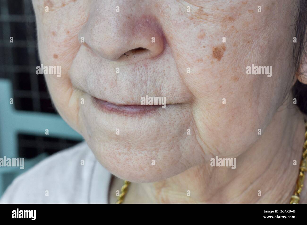 Pieghe della pelle o pieghe della pelle o rughe e pori larghi alla faccia della donna anziana del sud-est asiatico, cinese. Foto Stock
