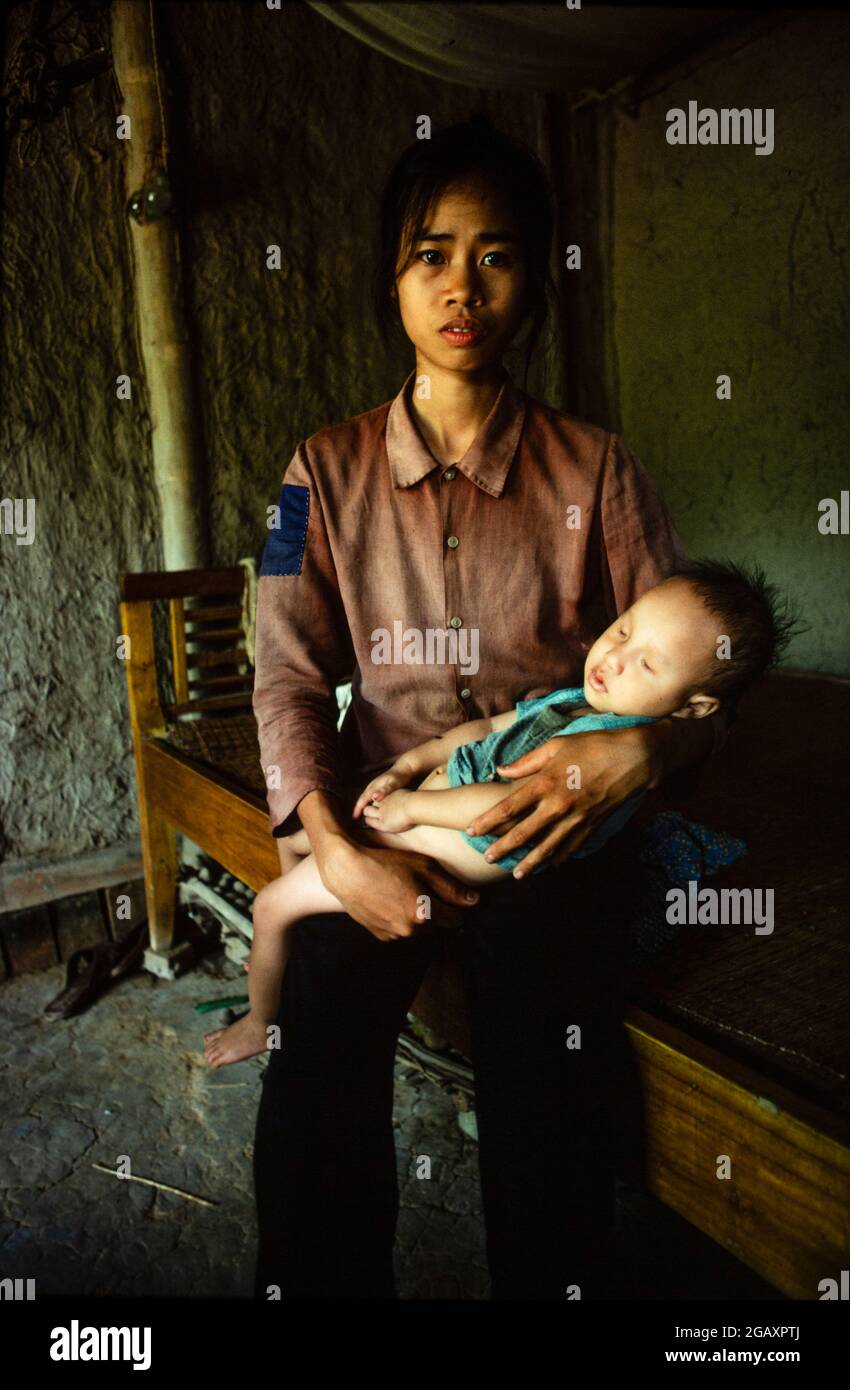 Pham Thi Huan, 24 anni, con il suo primo figlio, Bui Van Xuan, ha 20 mesi. Non può né parlare, né alzarsi e non ha occhi. Suo padre, bui Van Tram, 28 anni, veterano di guerra, fu spruzzato tre volte con l'Agente Orange. Giugno 1980 Foto Stock