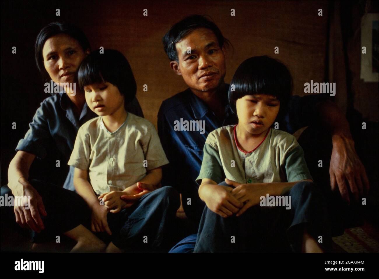 Le sorelle Lien, 8 anni, e Hien, 6 anni, sono nate dopo che il loro padre è stato spruzzato durante la guerra del Vietnam con l'agente Orange dagli aerei degli Stati Uniti. Né hanno lenti nei loro occhi. Foto Stock