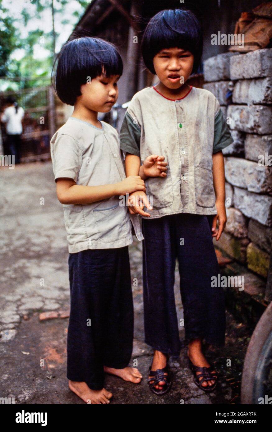 Le sorelle Lien, 8 anni, e Hien, 6 anni, sono nate dopo che il loro padre è stato spruzzato durante la guerra del Vietnam con l'agente Orange dagli aerei degli Stati Uniti. Né hanno lenti nei loro occhi. Foto Stock