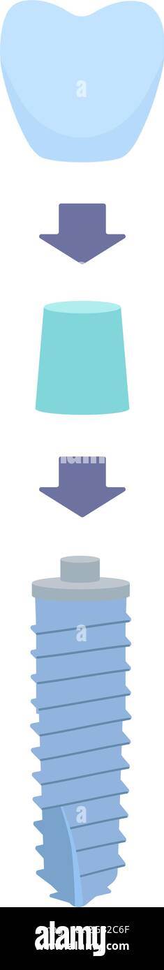 Lo schema dentale con frecce come corona è installato sul moncone, e poi sull'impianto dentale. Illustrazione vettoriale, in uno stile piatto con una linea sottile. All'interno della cavità orale, le gengive, le radici. Illustrazione Vettoriale