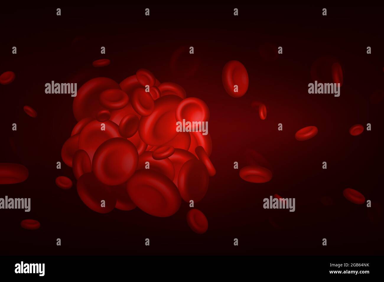 Coaguli di sangue, trombo o embolo con eritrociti coagulati. Illustrazione Vettoriale