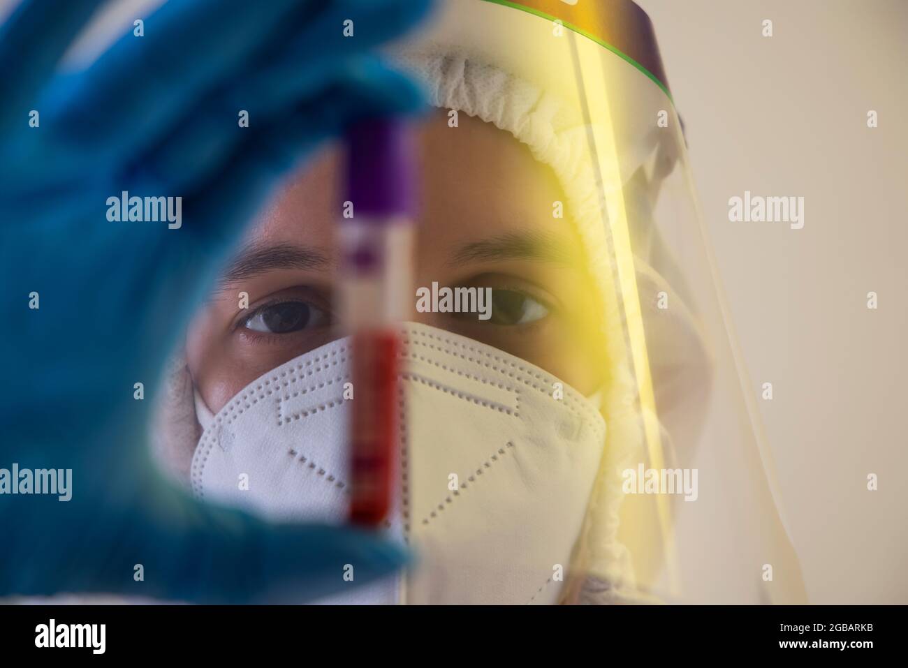 Un medico con schermo facciale che contiene un flacone di campione di sangue. Foto Stock