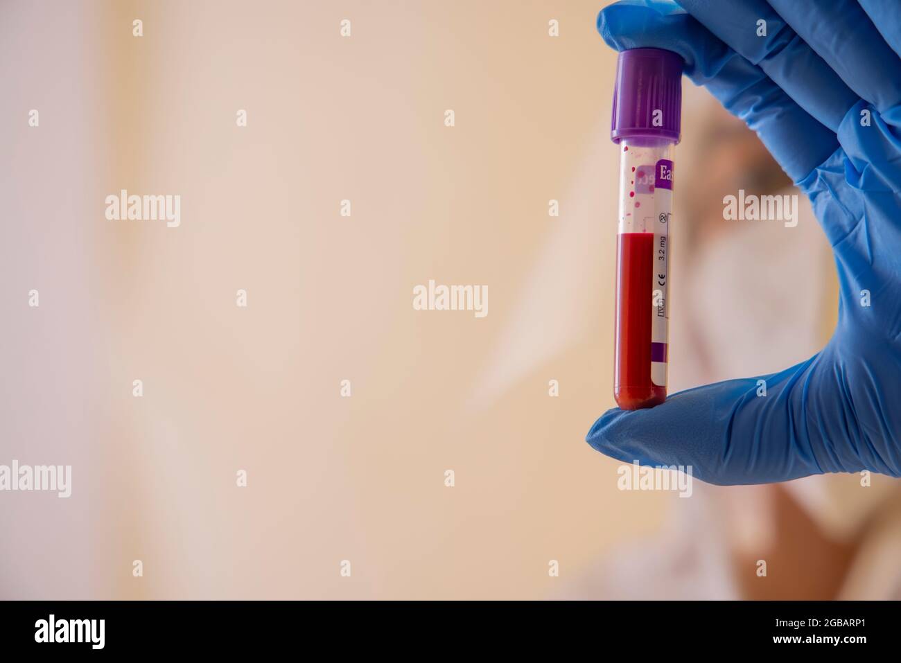 Una mano del medico che tiene un flacone di campione di sangue. Foto Stock