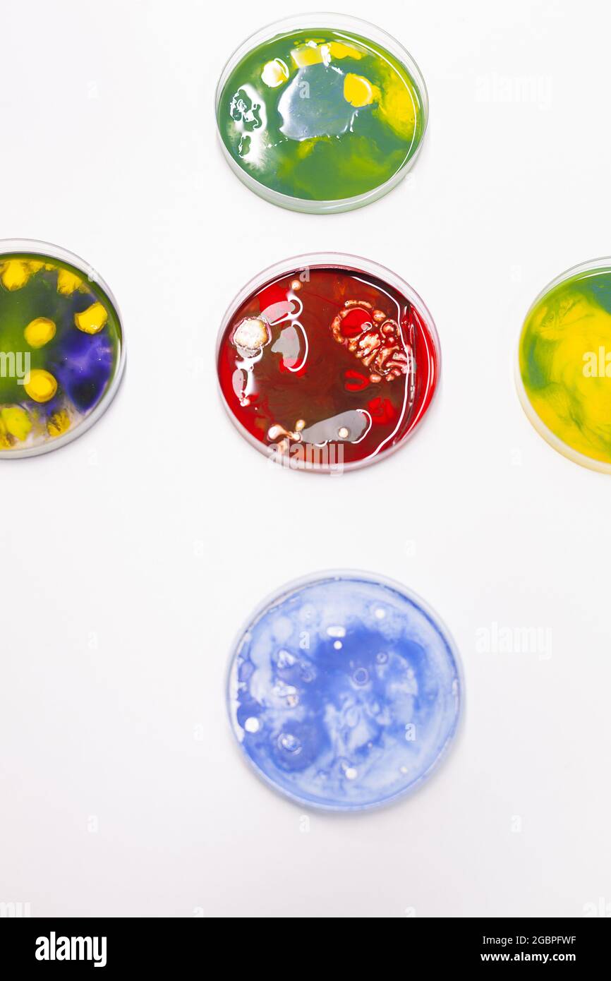 Misto di colonia di batteri in capsula di Petri in piedi sul tavolo in laboratorio biologico scientifico ospedaliero. Campione liquido di microrganismo farmaceutico. Microrganismo medico liquido Foto Stock