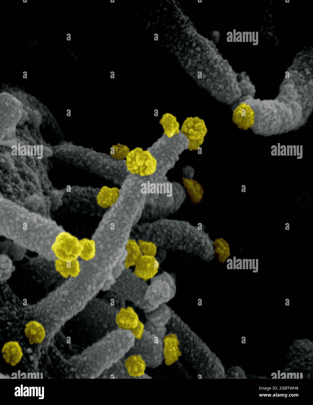 Novel Coronavirus SARS-COV-2 questa immagine al microscopio elettronico a scansione mostra SARS-COV-2 (particelle rotonde gialle) che emergono dalla superficie di una cellula coltivata nel laboratorio. SARS-COV-2, noto anche come 2019-nCoV, è il virus che causa COVID-19. Immagine catturata e colorata presso i Rocky Mountain Laboratories di Hamilton, Montana. Credito: NIAID Foto Stock