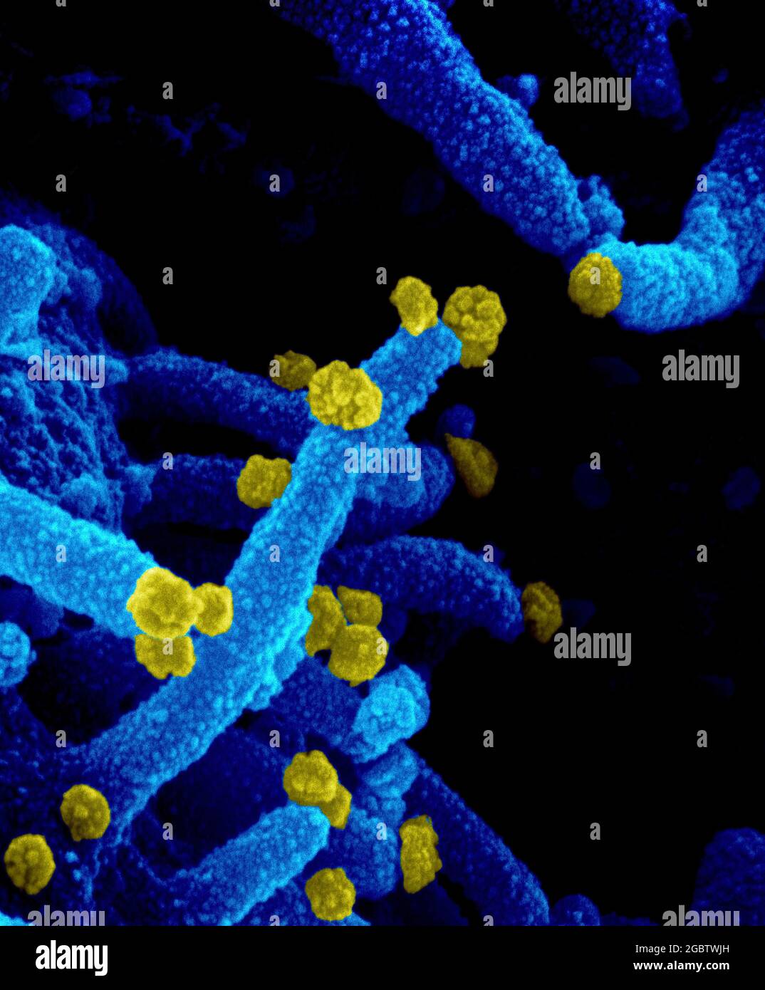 Novel Coronavirus SARS-COV-2 questa immagine al microscopio elettronico a scansione mostra SARS-COV-2 (particelle rotonde gialle) che emergono dalla superficie di una cellula coltivata nel laboratorio. SARS-COV-2, noto anche come 2019-nCoV, è il virus che causa COVID-19. Immagine catturata e colorata presso i Rocky Mountain Laboratories di Hamilton, Montana. Credito: NIAID Foto Stock