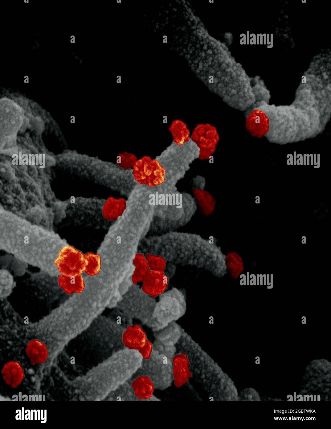 Novel Coronavirus SARS-COV-2 questa immagine al microscopio elettronico a scansione mostra SARS-COV-2 (particelle rosse rotonde) che emergono dalla superficie di una cellula coltivata nel laboratorio. SARS-COV-2, noto anche come 2019-nCoV, è il virus che causa COVID-19. Immagine catturata e colorata presso i Rocky Mountain Laboratories di Hamilton, Montana. Credito: NIAID Foto Stock