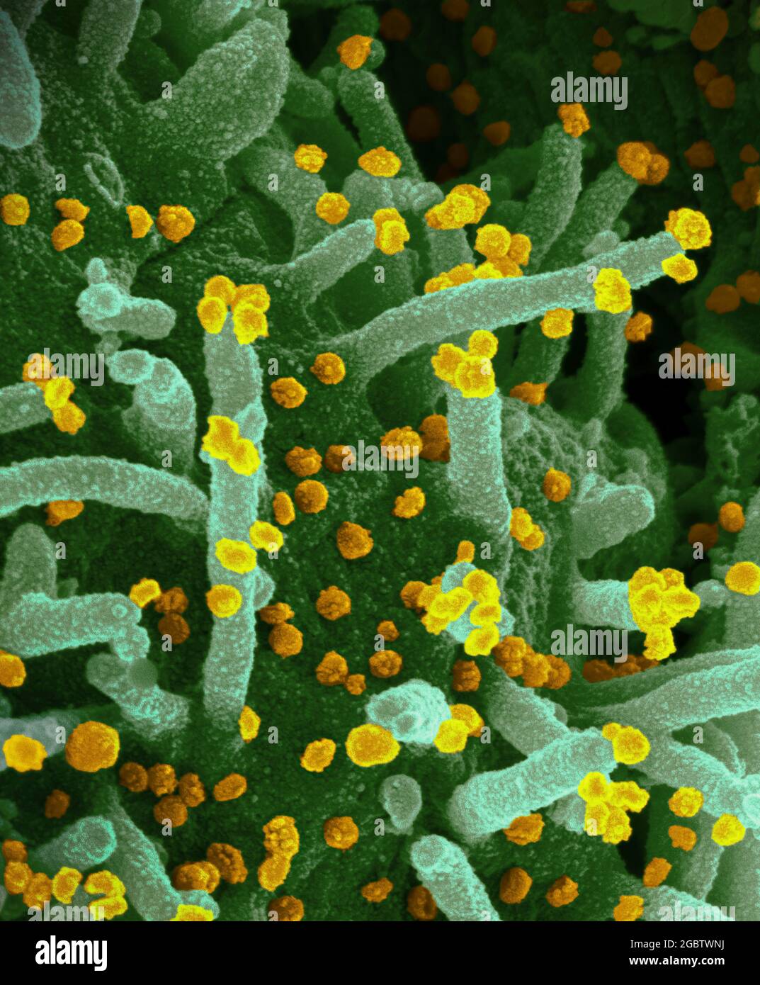 Novel Coronavirus SARS-COV-2 questa immagine al microscopio elettronico a scansione mostra SARS-COV-2 (particelle d'oro rotonde) che emergono dalla superficie di una cellula coltivata nel laboratorio. SARS-COV-2, noto anche come 2019-nCoV, è il virus che causa COVID-19. Immagine catturata e colorata presso i Rocky Mountain Laboratories di Hamilton, Montana. Credito: NIAID Foto Stock