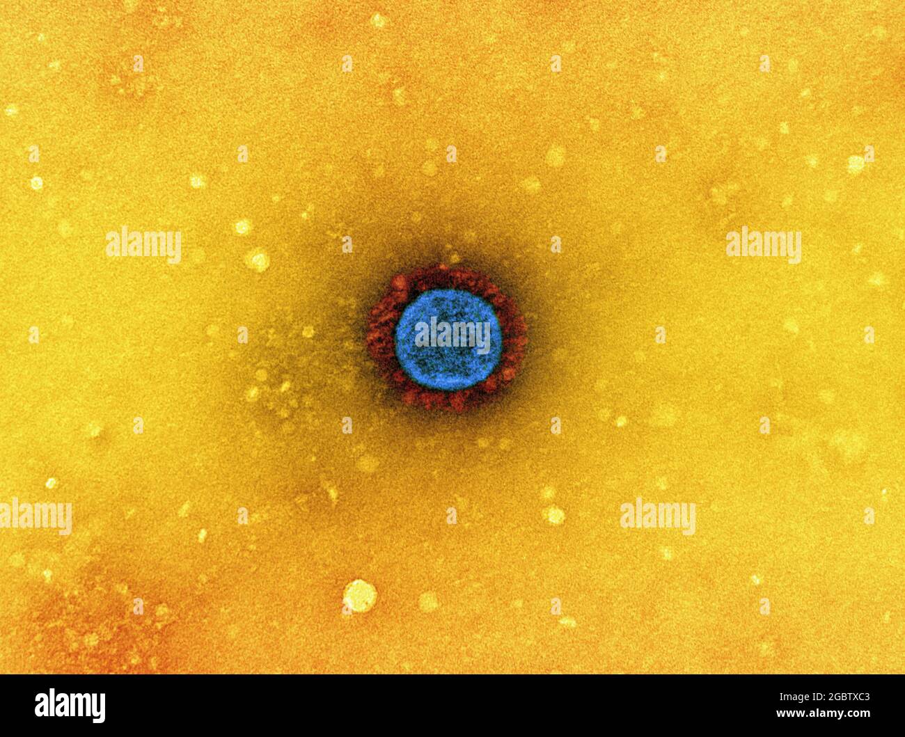 Novel Coronavirus SARS-COV-2 Micrografia elettronica di trasmissione di una particella di virus SARS-COV-2 (variante UK B.1.1.7), isolata da un campione di paziente e coltivata in coltura cellulare. Le sporgenze prominenti (rosse) visibili all'esterno della particella virale (blu) sono proteine di picco. Questa frangia di proteine consente al virus di attaccarsi e infettare le cellule ospiti e poi replicarsi. Immagine catturata presso la NIAID Integrated Research Facility (IRF) di Fort Detrick, Maryland. Credito: NIAID Foto Stock