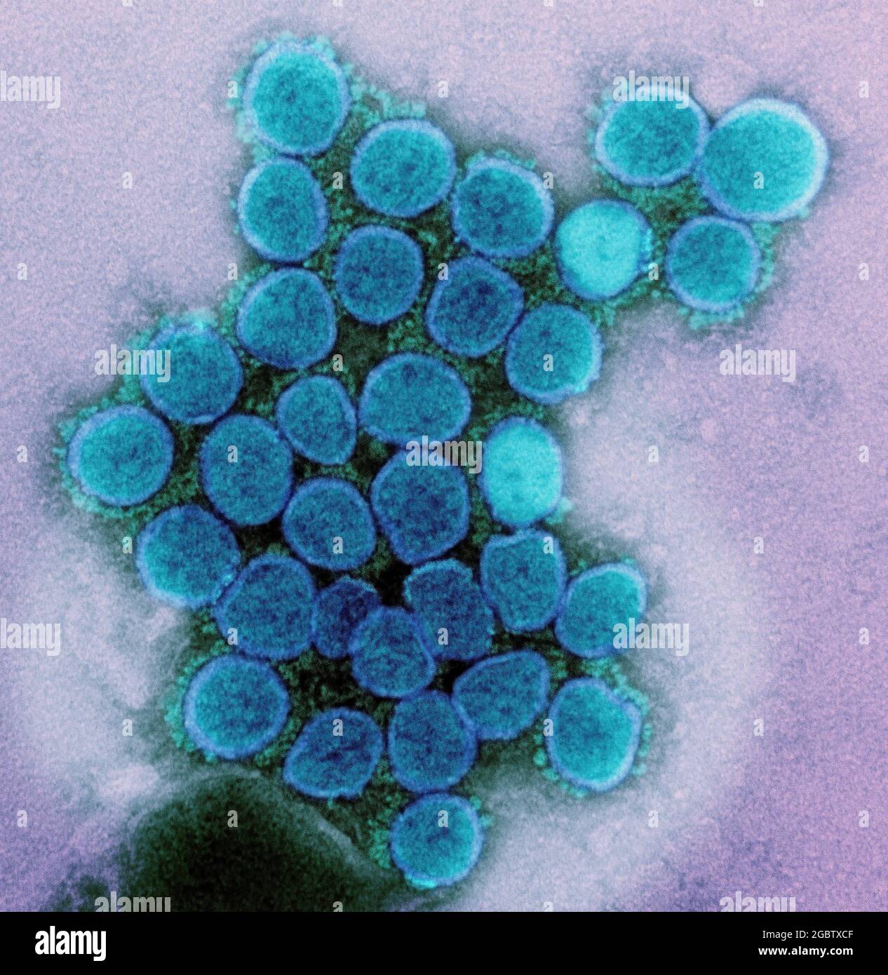 Micrografia elettronica di trasmissione di un ceppo variante di particelle di virus SARS-COV-2 (UK B.1.1.7), isolato da un campione di paziente e coltivato in coltura cellulare. Immagine catturata presso la NIAID Integrated Research Facility (IRF) di Fort Detrick, Maryland. Credito: NIAID Foto Stock