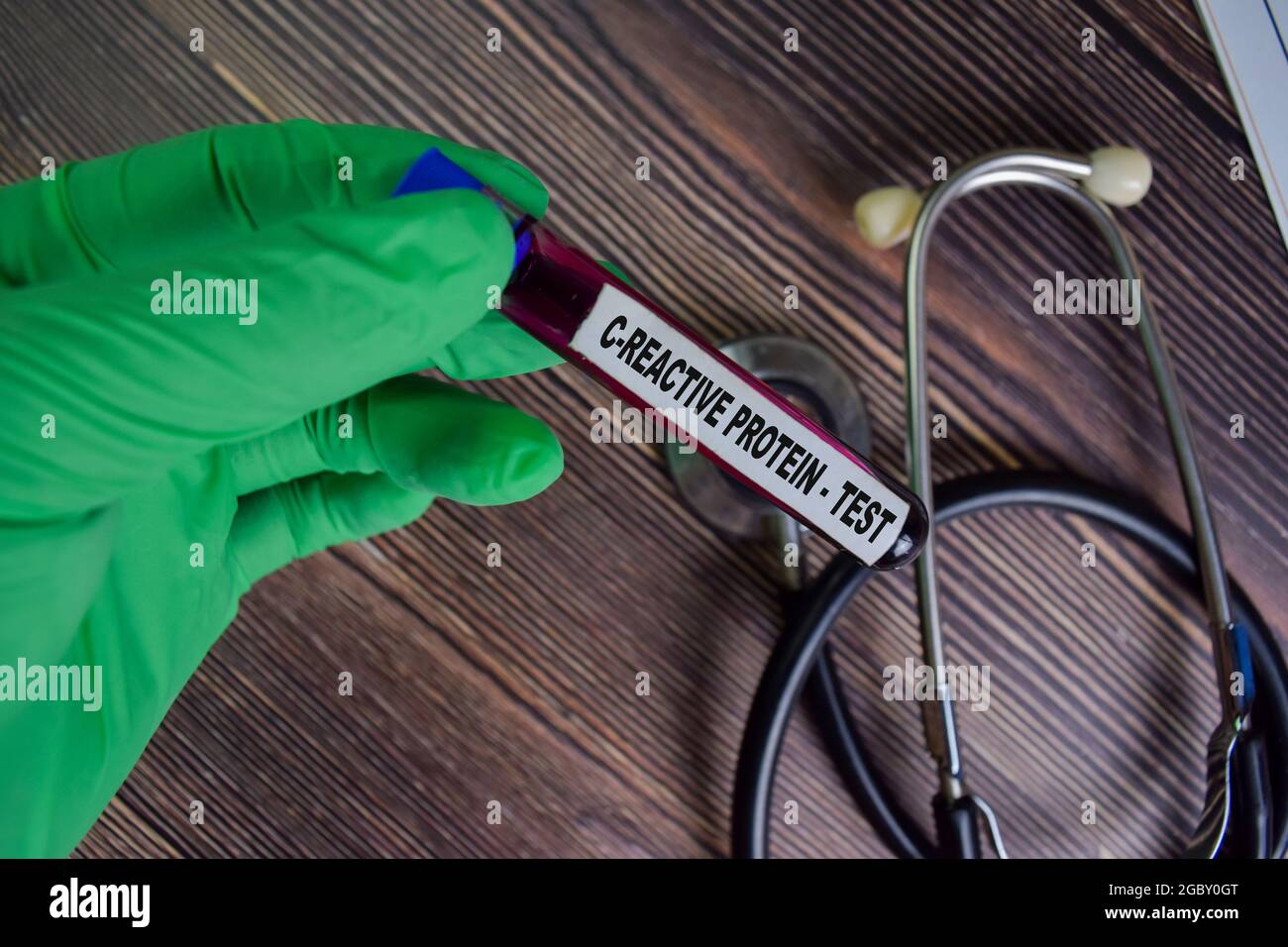 Proteina C-reattiva - Test con campione di sangue. Vista dall'alto isolata sulla scrivania dell'ufficio. Concetto sanitario/medico Foto Stock