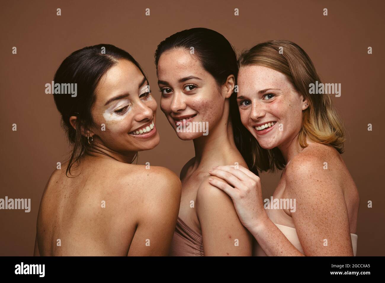 Primo piano di tre donne che hanno problemi di pelle in piedi insieme su sfondo marrone. Giovani donne sicure con imperfezioni della pelle che riflettono i posi del corpo Foto Stock