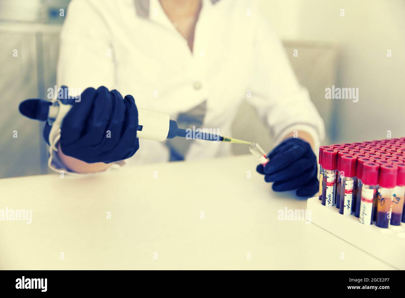 Operaio laboatorio che effettua l'analisi del sangue tenendo una provetta di campione di sangue per lo studio. Tonalità seppia Foto Stock