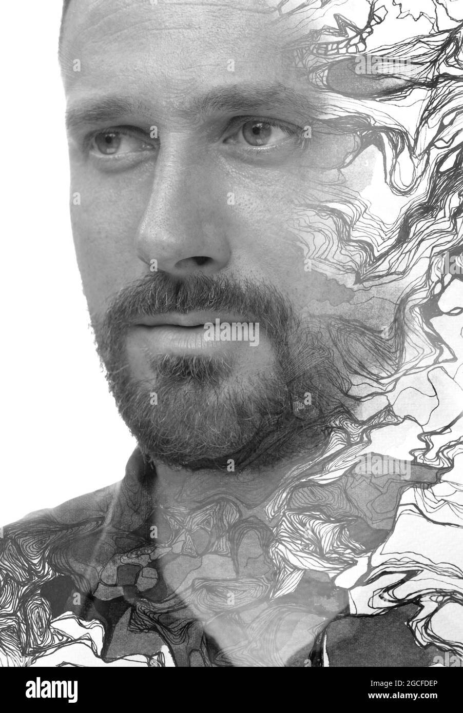 Un ritratto blotchy dell'uomo Foto Stock