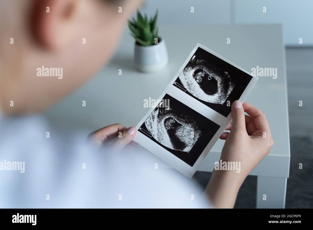 Vista posteriore della donna caucasica incinta sconosciuta che tiene e guarda la foto della sua prima scansione ecografica del concetto di maternità del bambino Foto Stock
