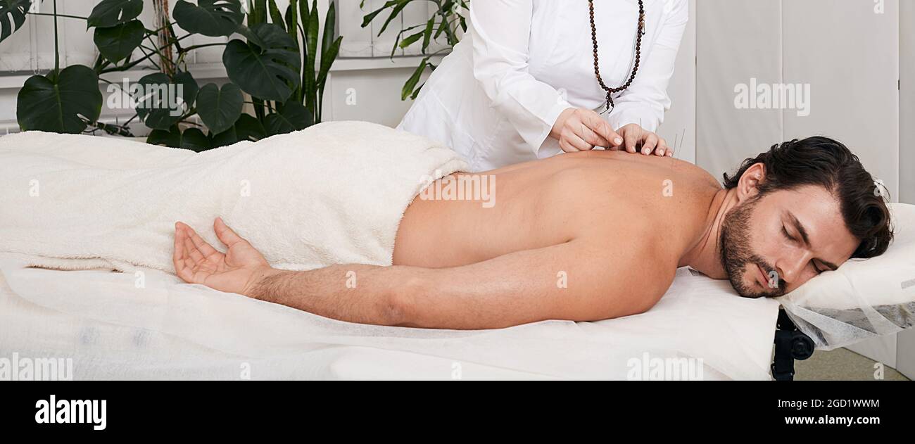 Trattamento del dolore alla schiena con aghi per agopuntura per pazienti umani. Medicina tradizionale cinese Foto Stock