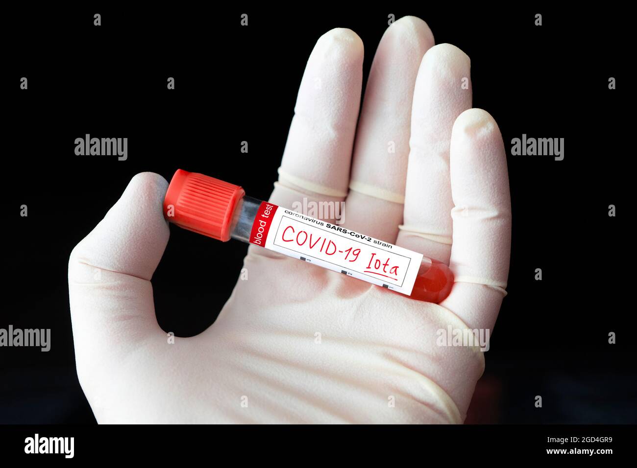 Medico con un campione di sangue positivo per la nuova variante rilevata del ceppo di coronavirus chiamato covid Iota. Ricerca di nuovi ceppi e mutazioni di Foto Stock
