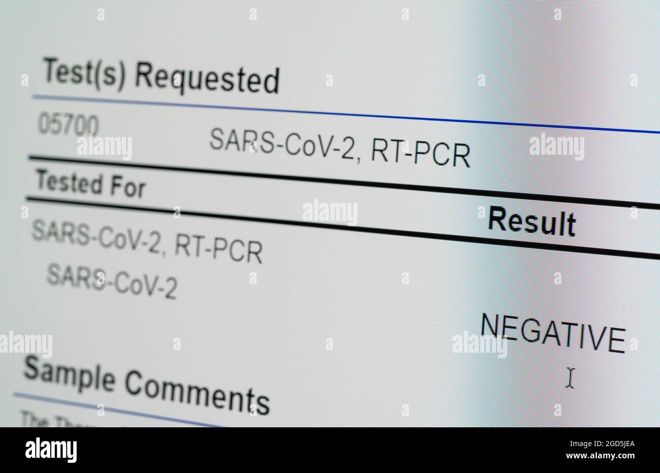 Lo schermo del computer mostra un risultato negativo per il test PCR su tampone nasale per SARS-COV-2 o Covid-19 Foto Stock