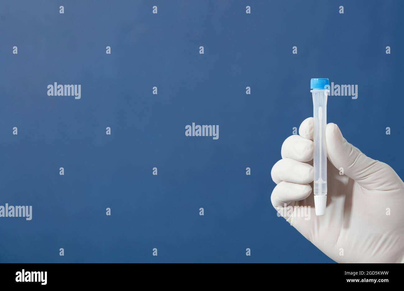 fiala per il trasporto in laboratorio, con adesivo dei dati personali nelle mani del medico, con sfondo blu Foto Stock