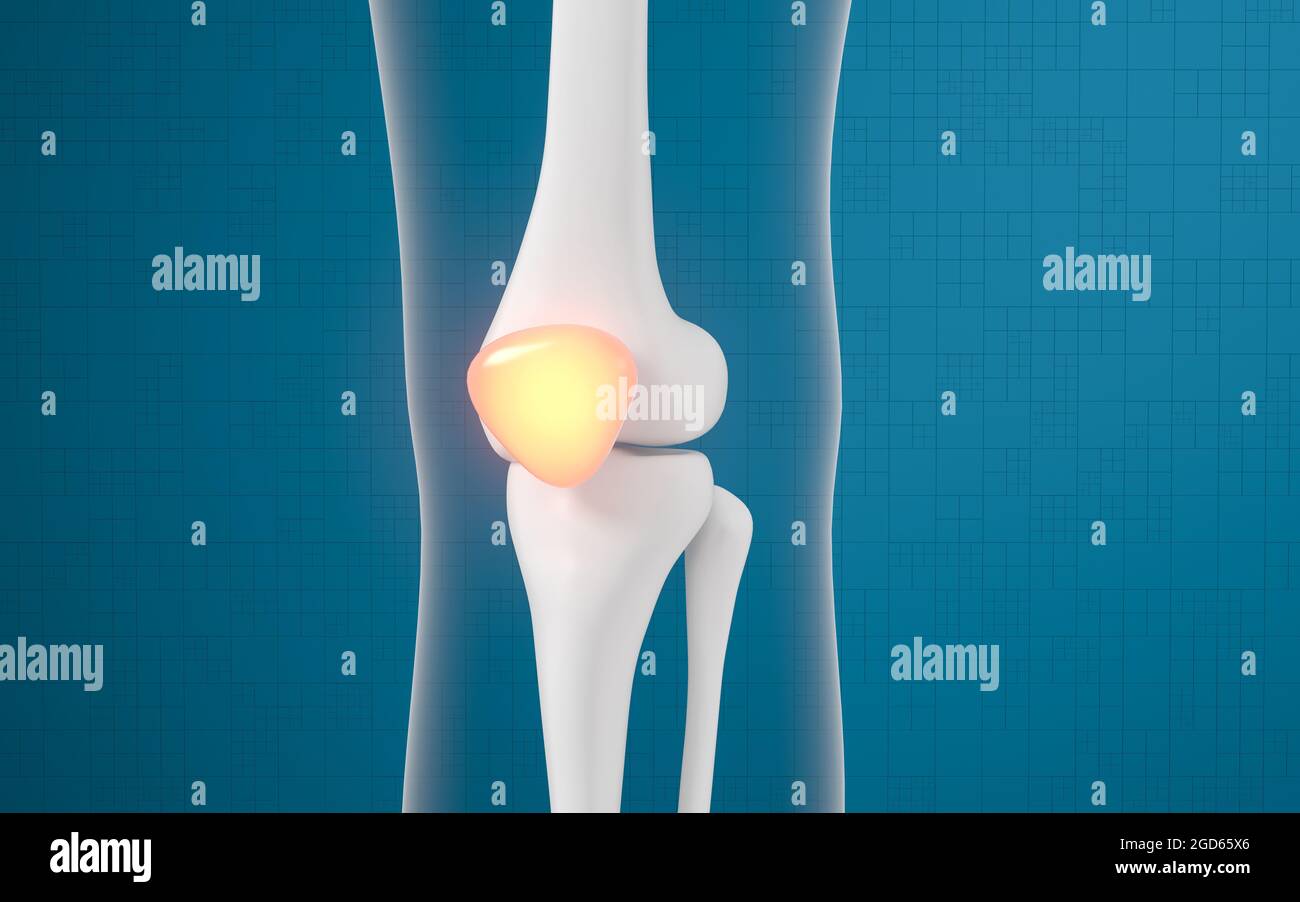 Lesioni alle ossa e alle ginocchia delle gambe, rendering 3d. Disegno digitale per computer. Foto Stock