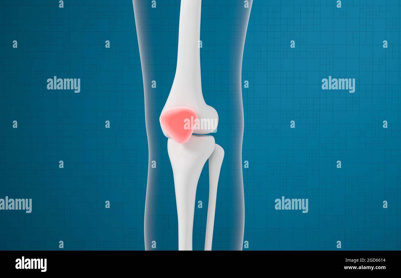 Lesioni alle ossa e alle ginocchia delle gambe, rendering 3d. Disegno digitale per computer. Foto Stock