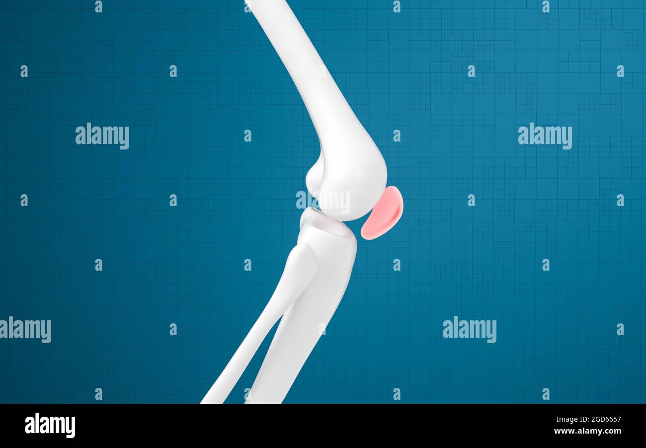 Lesioni alle ossa e alle ginocchia delle gambe, rendering 3d. Disegno digitale per computer. Foto Stock