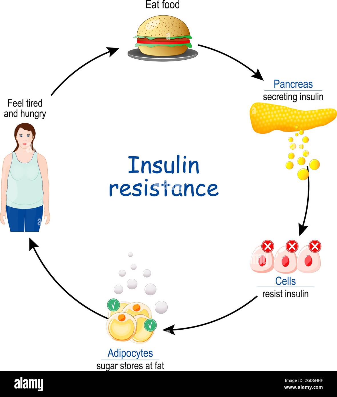 Resistenza all'insulina. Ciclo di insulina e glucosio, prima e dopo il consumo alimentare. Illustrazione vettoriale. Illustrazione Vettoriale