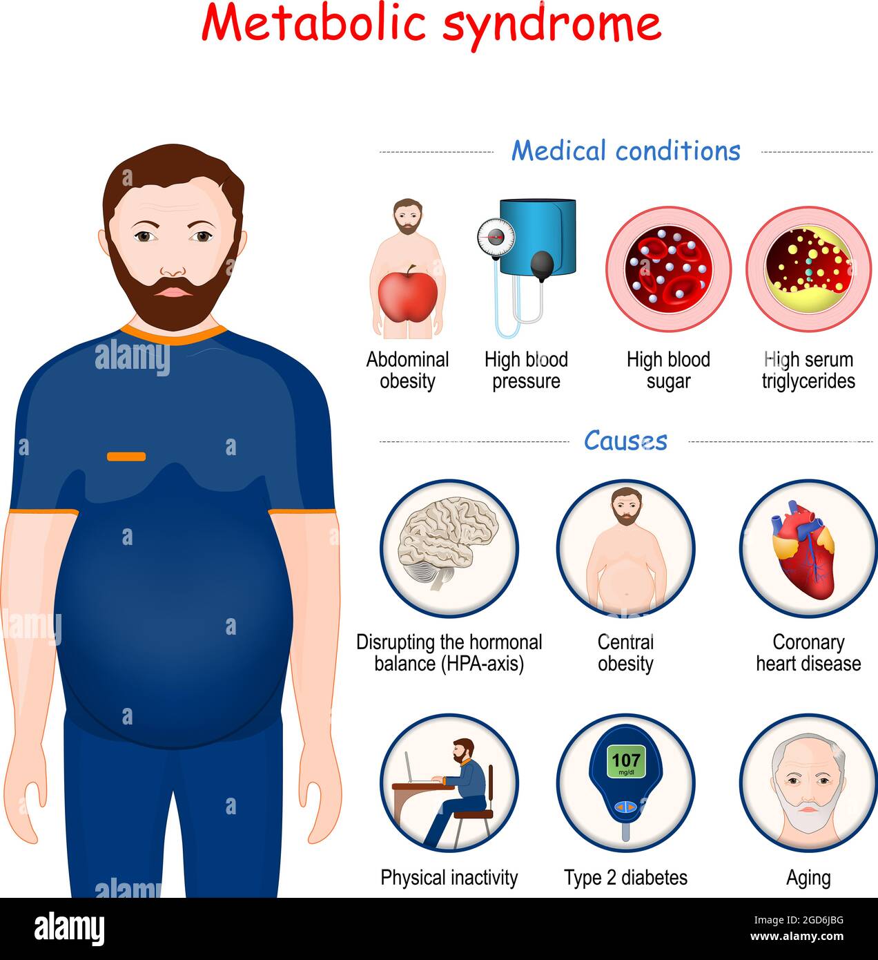 Sindrome metabolica. Infografica cause e condizioni mediche. Metabolismo umano. Uomo con obesità addominale. Illustrazione vettoriale Illustrazione Vettoriale
