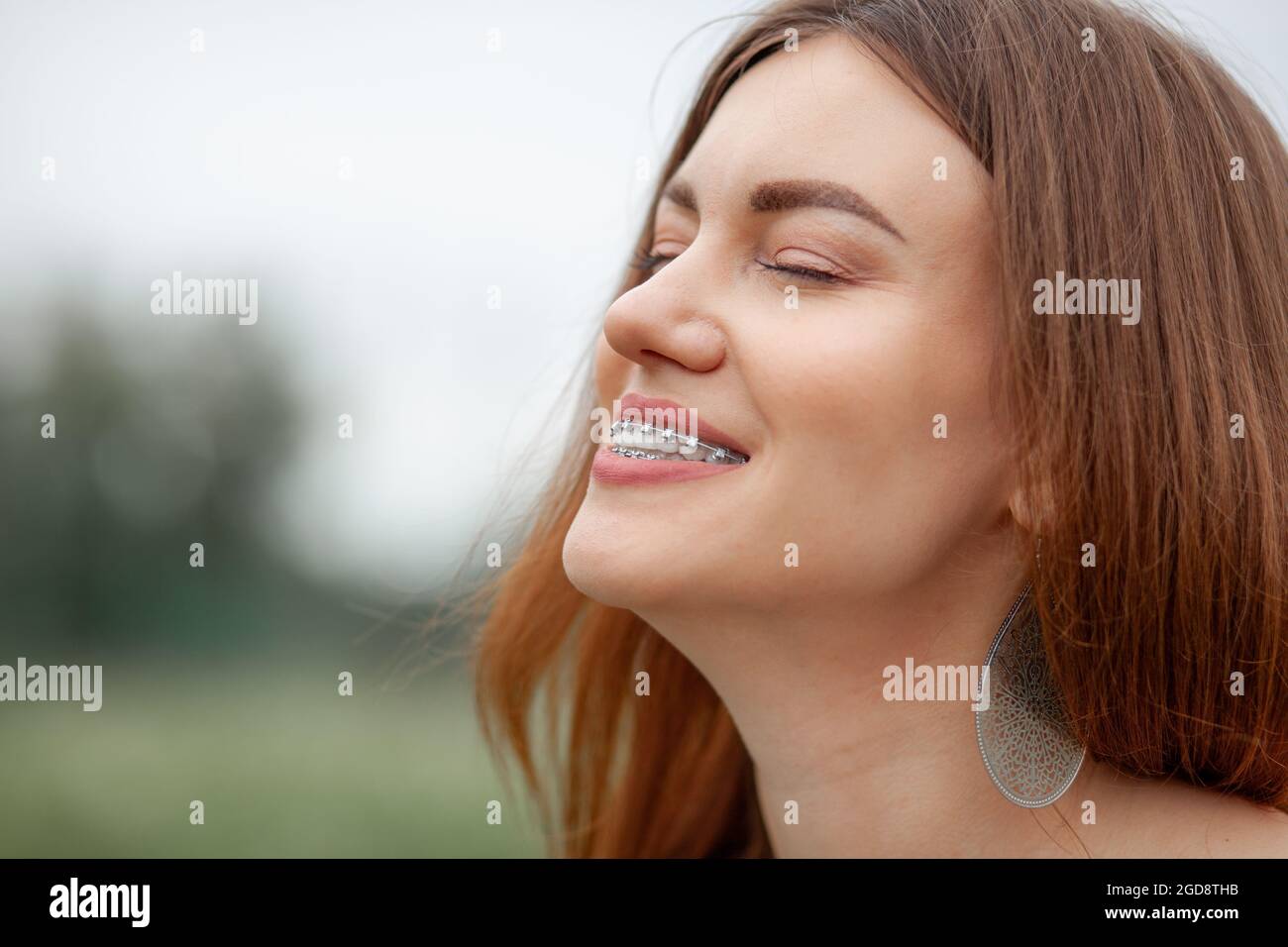 Il sorriso di una giovane e bella ragazza con bretelle sui denti bianchi. Raddrizzatura dei denti storti con l'ausilio di un sistema a staffa. Malocclusione Foto Stock