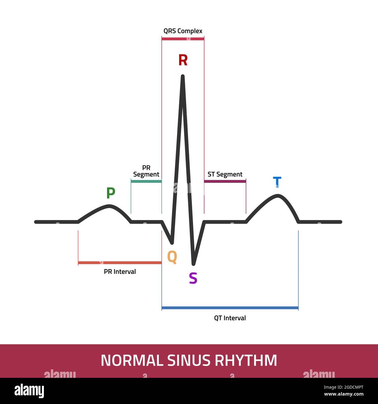 EKG che mostra la normale onda del battito cardiaco. ECG del diagramma infografico del ritmo sinusale normale. Illustrazione Vettoriale