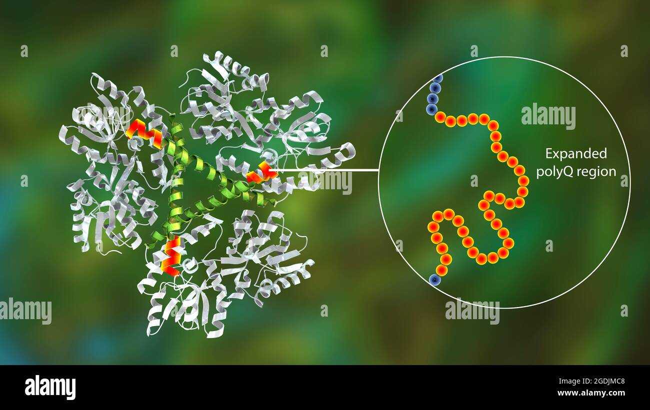 Proteina Huntingtin mutante, illustrazione Foto Stock