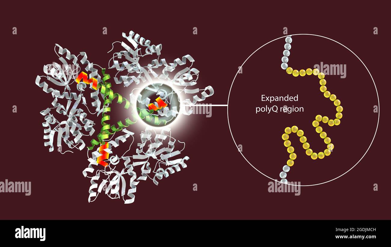 Proteina Huntingtin mutante, illustrazione Foto Stock