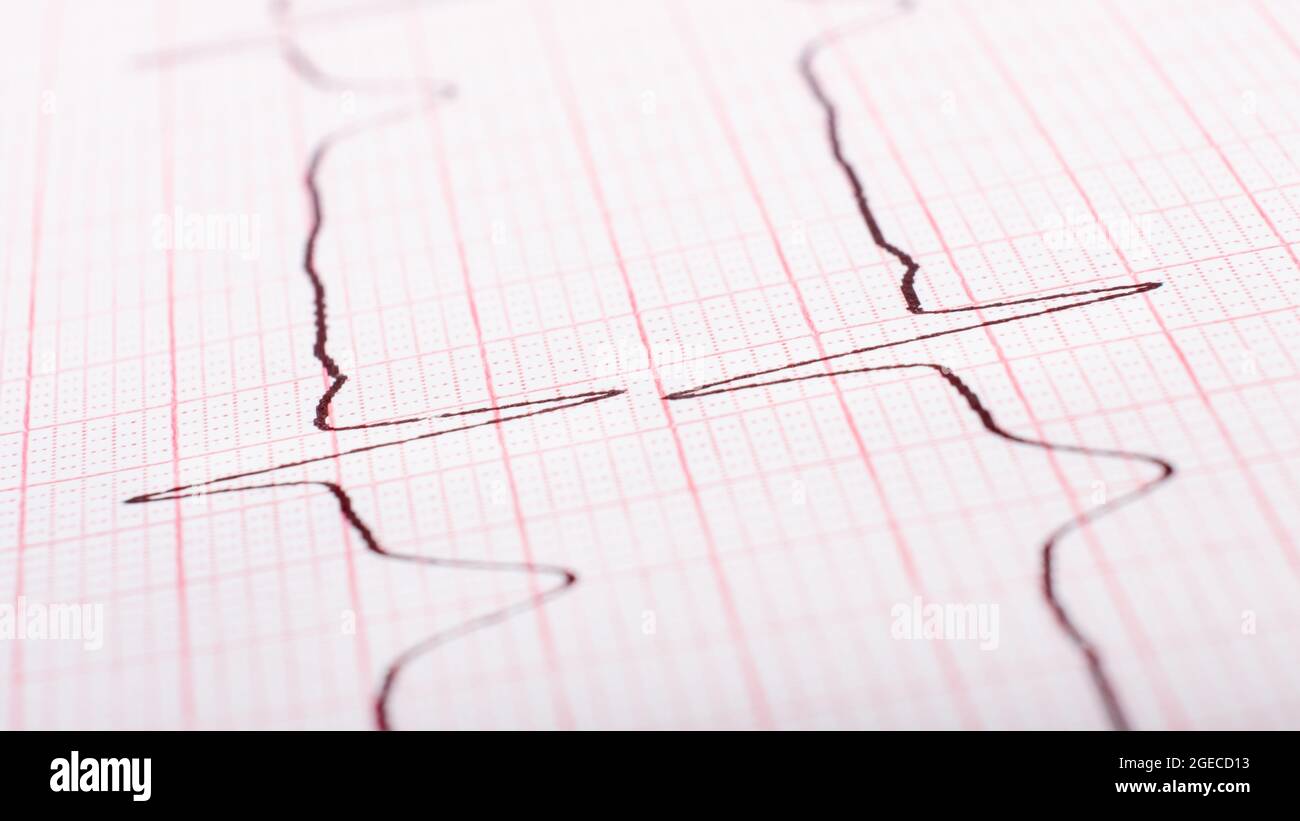 frequenza cardiaca su primo piano di cardiogramma cartaceo. Foto Stock