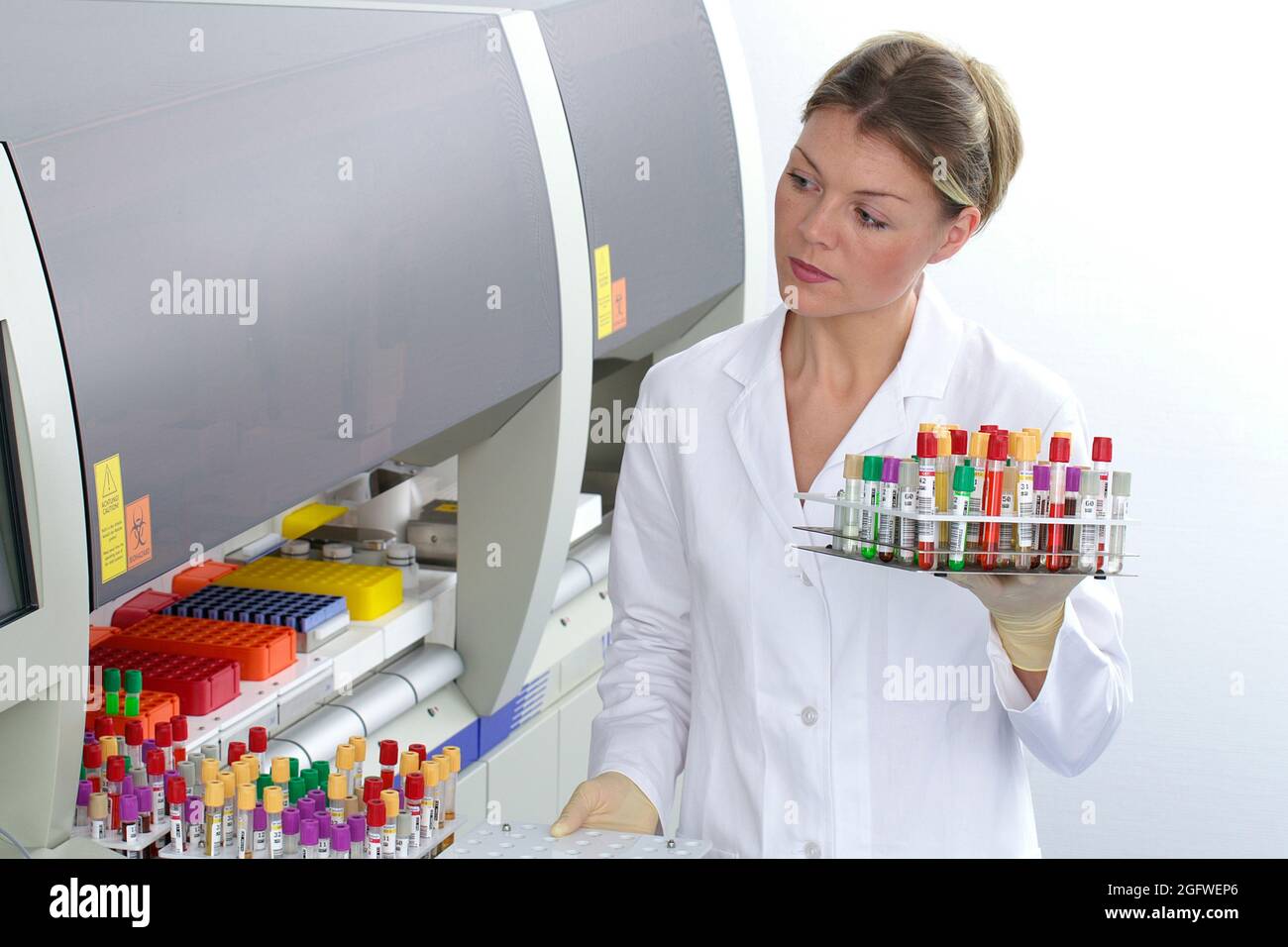 assistente di laboratorio femminile con campioni di sangue in laboratorio Foto Stock