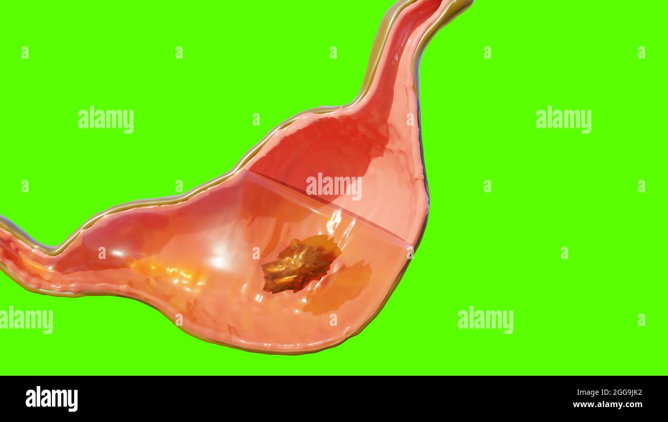 Illustrazione 3d della digestione dell'anatomia dello stomaco umano, reander 3D Foto Stock Illustrazione 3d della digestione dell'anatomia dello stomaco umano, reander 3D Foto Stock