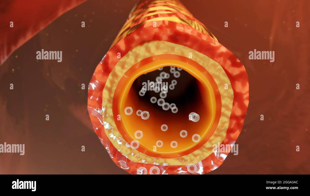 Illustrazione 3d dei sintomi dell'asma, trattamento, bronchiolo, rendering 3d Foto Stock