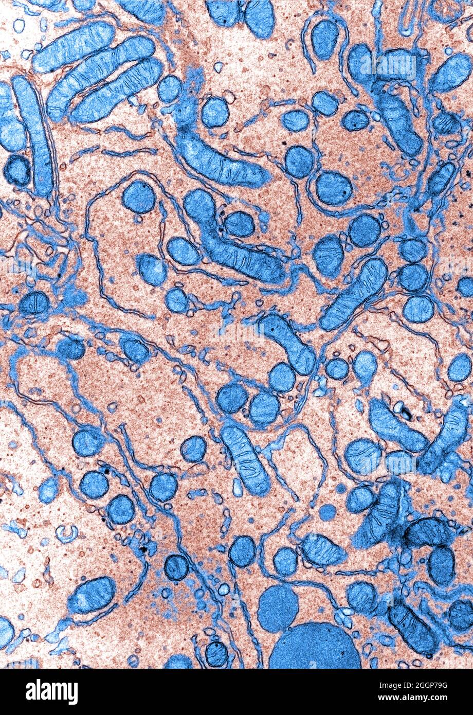 Micrografia elettronica a trasmissione colorata (TEM) di una cellula dagli effereni del dotto dello scoiattolo macinato. Foto Stock