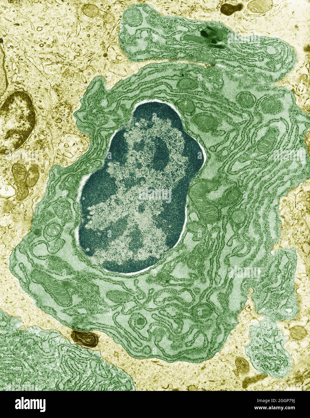 Micrografia elettronica a trasmissione colorata (TEM) della cellula intestinale, che mostra il nucleo e il reticolo endoplasmatico circostante e i mitocondri. Foto Stock