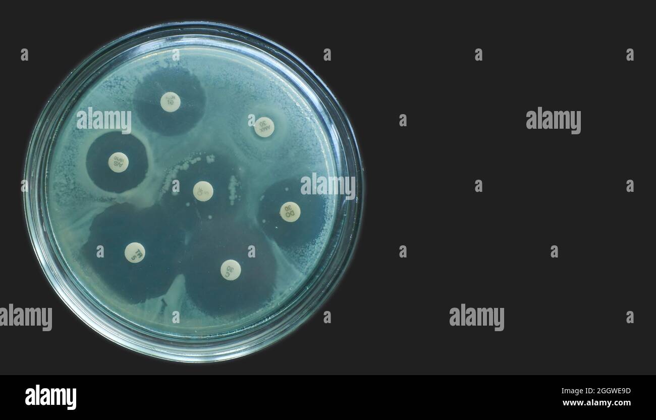 Test di suscettibilità antimicrobica mediante diffusione kirby bauer su sfondo scuro Foto Stock