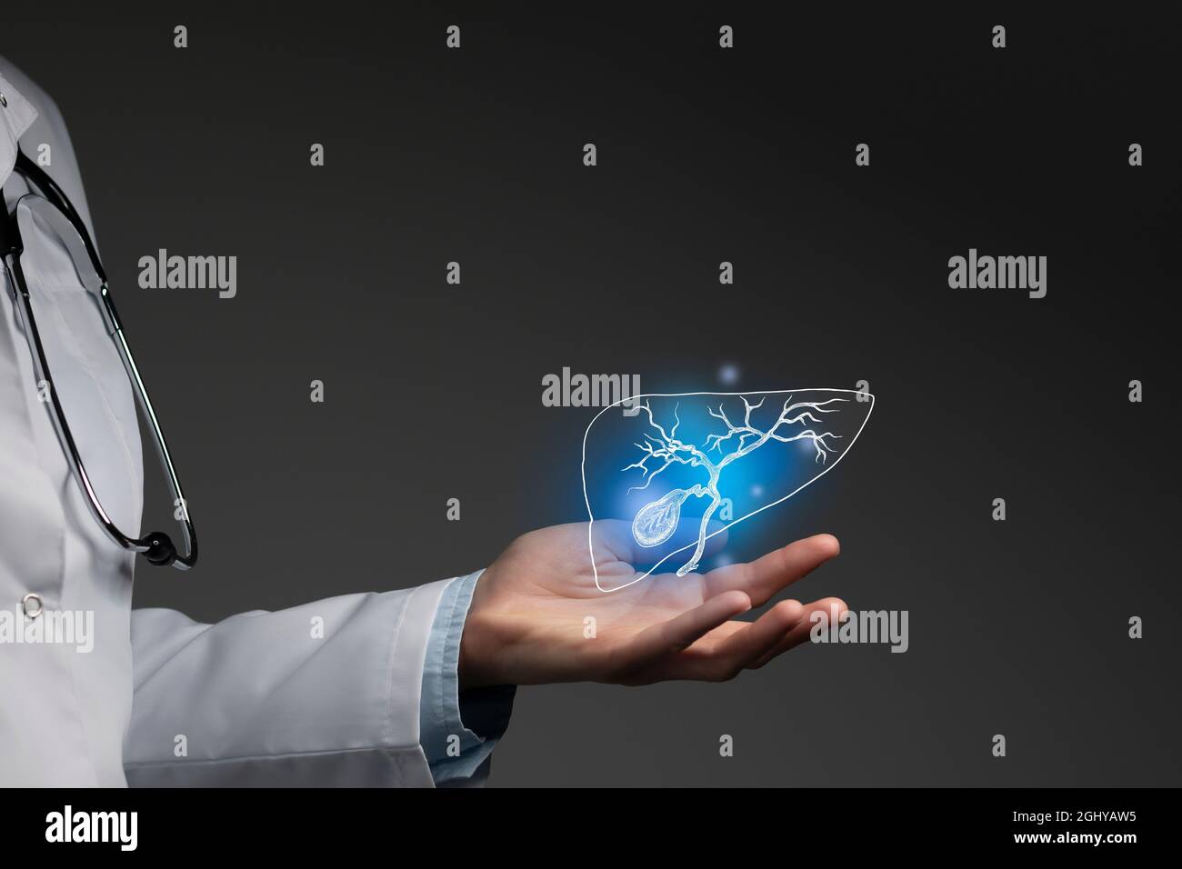 La cistifellea emette il concetto medico. Foto medico femminile, spazio vuoto. Foto Stock