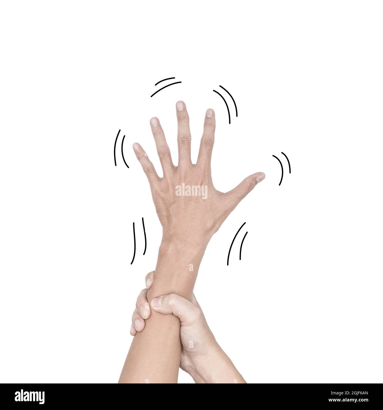 Tremore delle mani o del tremore essenziale nel giovane asiatico. Isolato su bianco. Foto Stock
