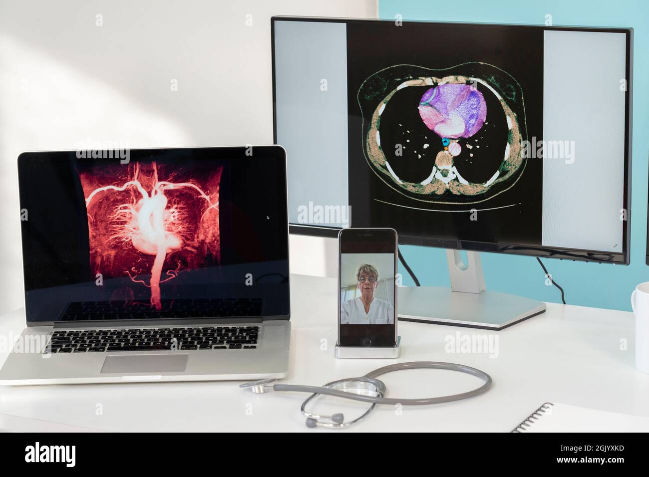 Teleconsulto tra due medici con immagini mediche di stomaci su uno degli schermi. Foto Stock