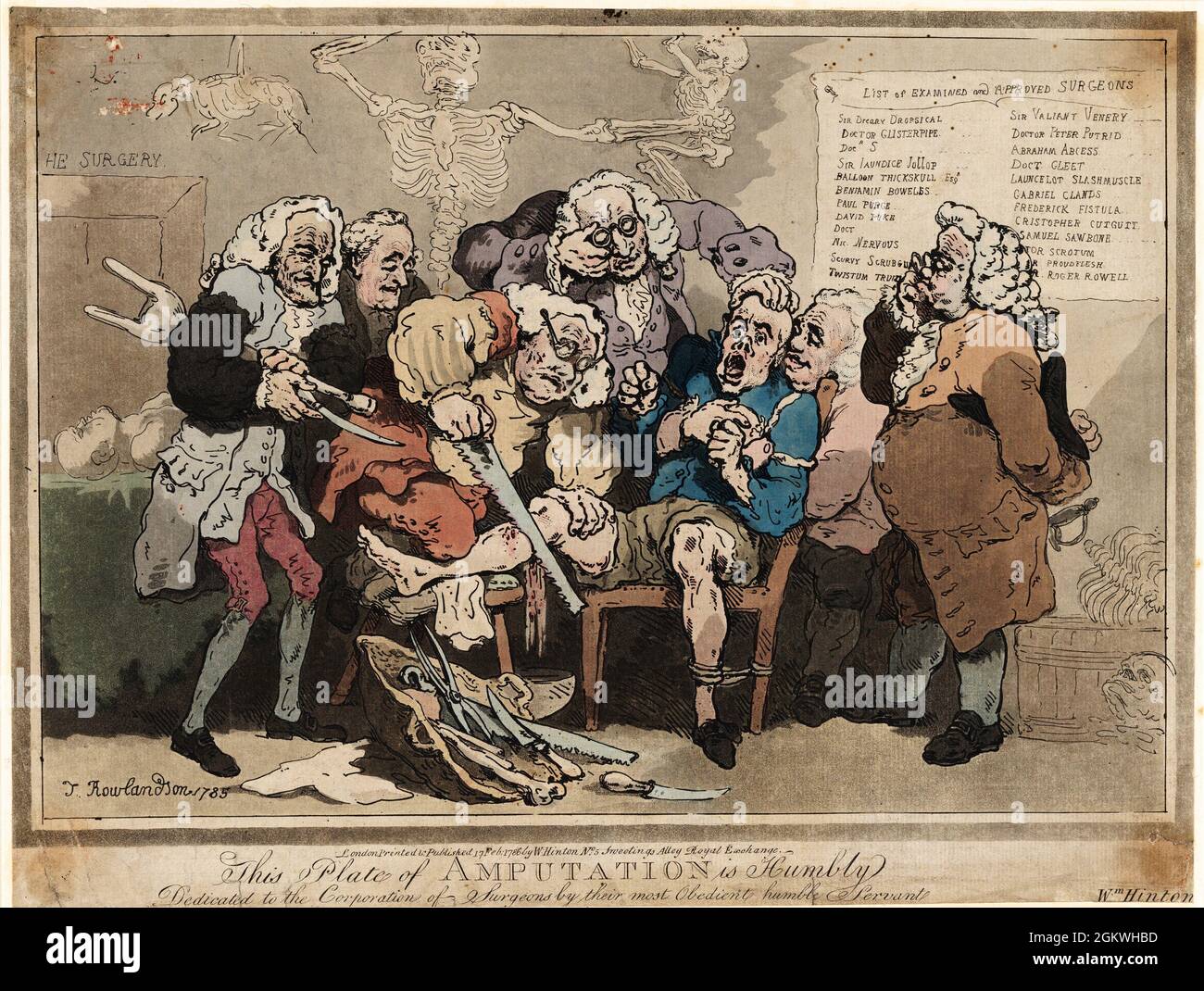 Amputazione 1786 artista: Thomas Rowlandson (1756-1827) artista e caricaturista inglese dell'era georgiana. Osservatore sociale, è stato un artista prolifico e tipografo. Credit: Thomas Rowlandson/Alamy Foto Stock