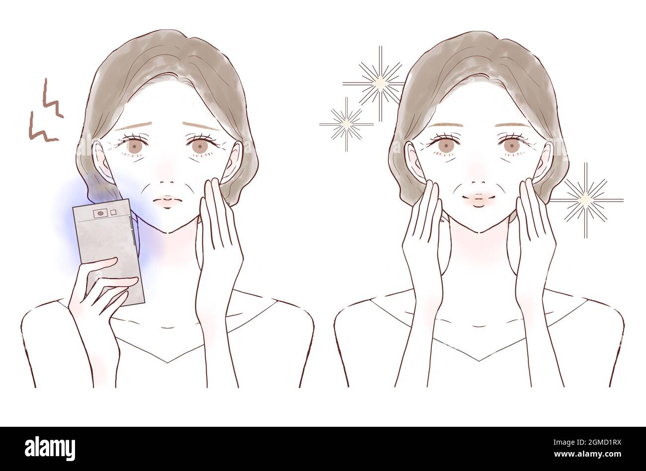 Una donna di mezza età che soffre di affaticamento degli occhi e perdita della vista a causa della luce blu sul suo smartphone. Prima e dopo.su sfondo bianco. Foto Stock