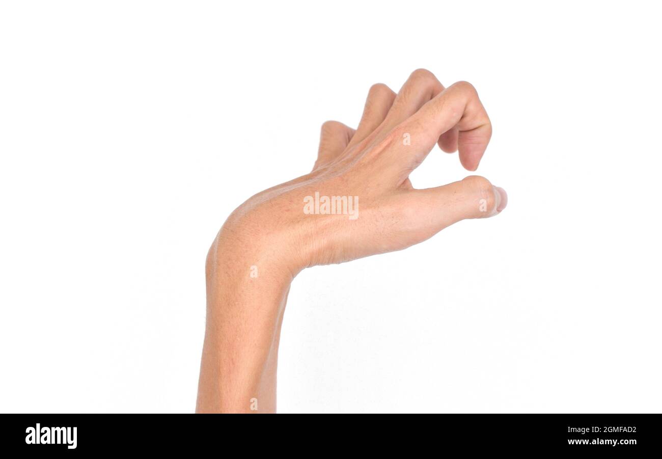 La contrattura di Volkmann nell’arto superiore sinistro del giovane sudorientale asiatico. È un accorciamento permanente dei muscoli dell'avambraccio che dà luogo ad un clawlike Foto Stock