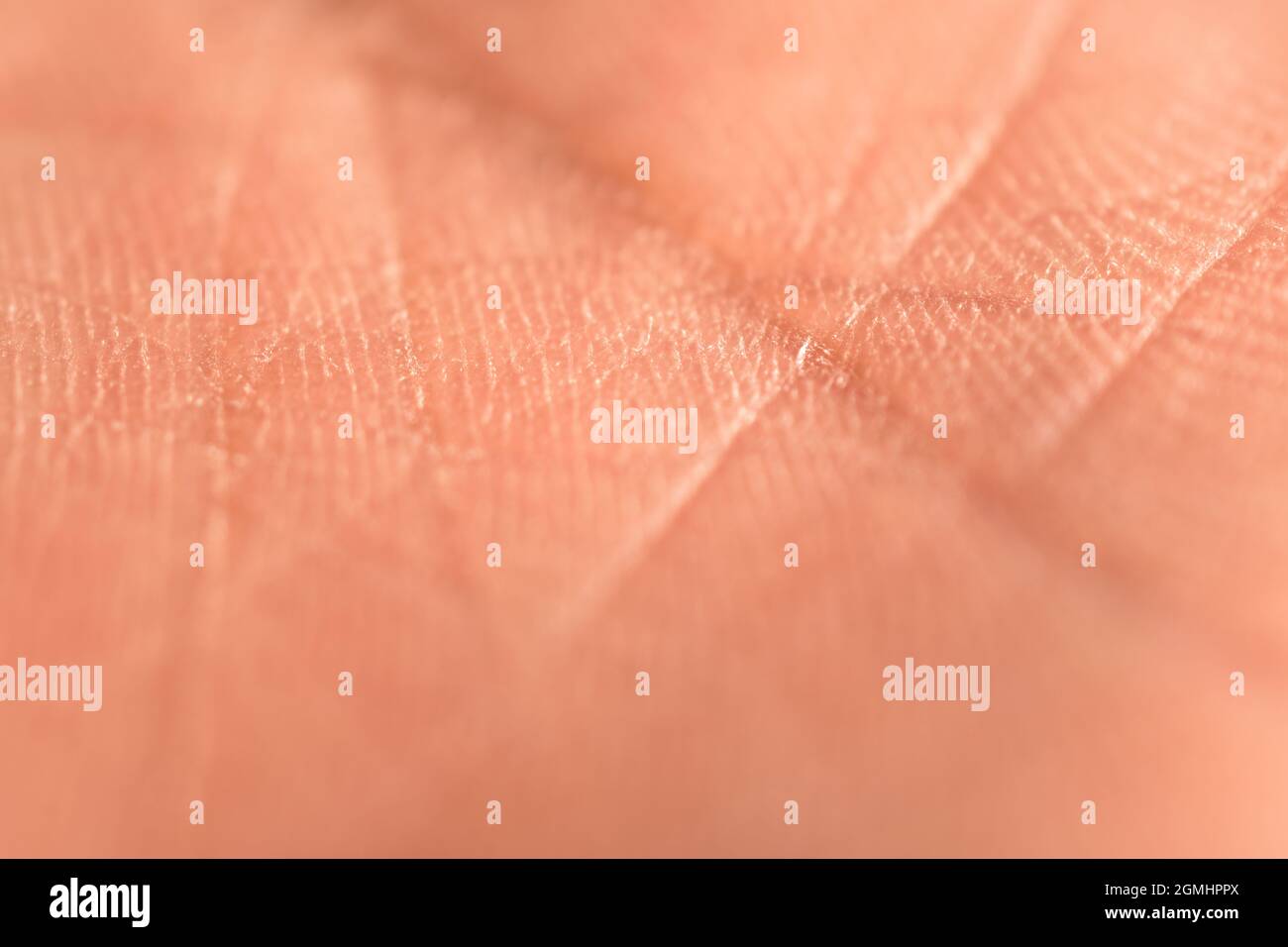 Primo piano di pelle asciutta in mano Foto Stock