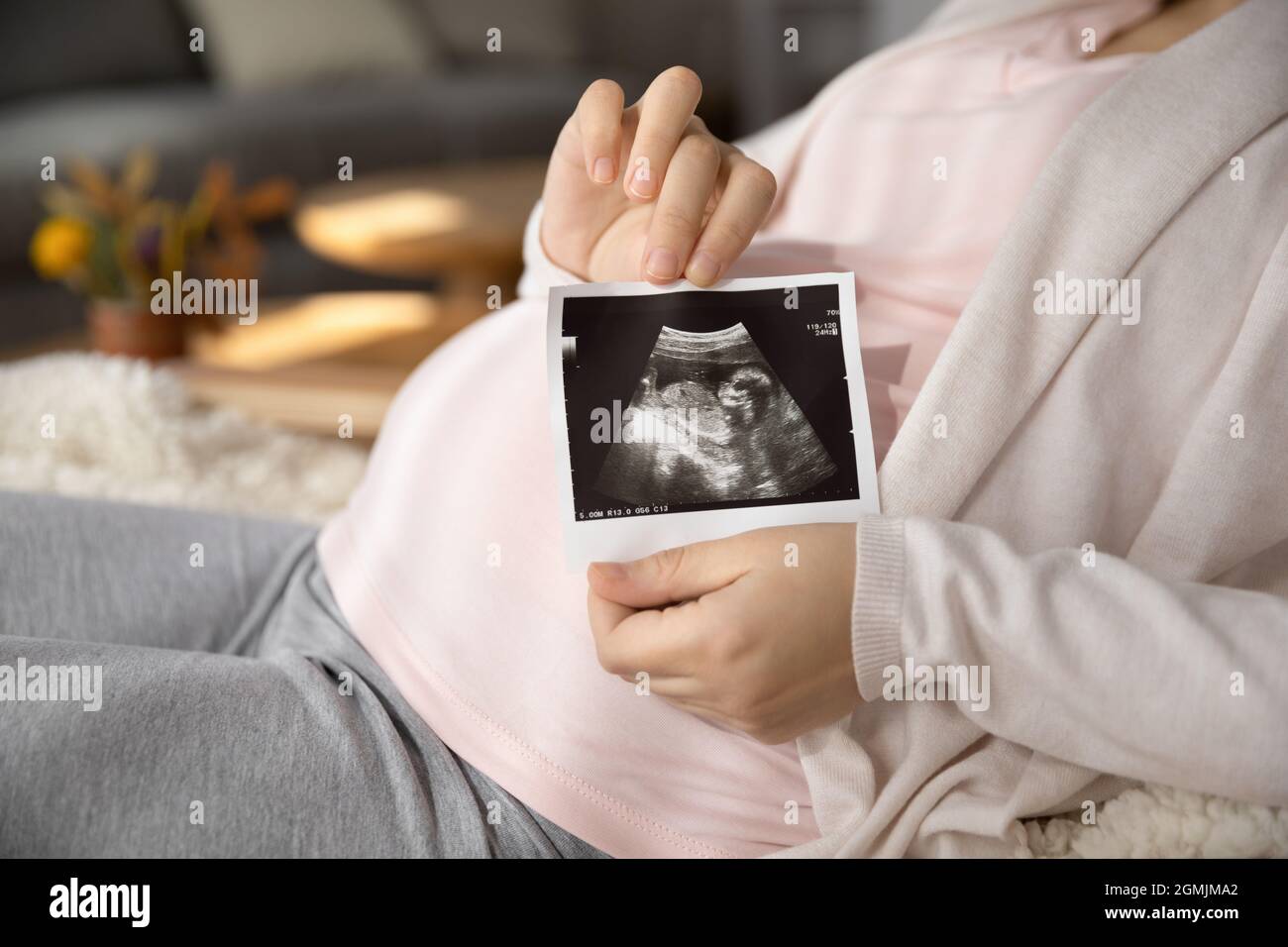 La giovane donna che si aspetta il bambino tiene l'immagine del sonogramma del bambino futuro Foto Stock