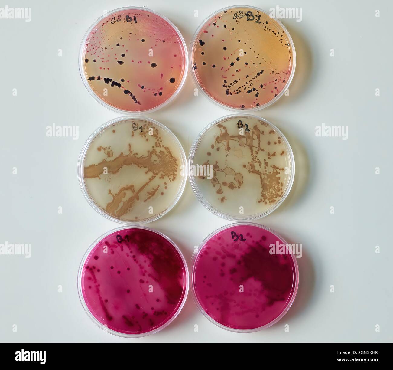 Colonia batterica su terreni selettivi piastre di agar in piastra Petri  Foto stock - Alamy